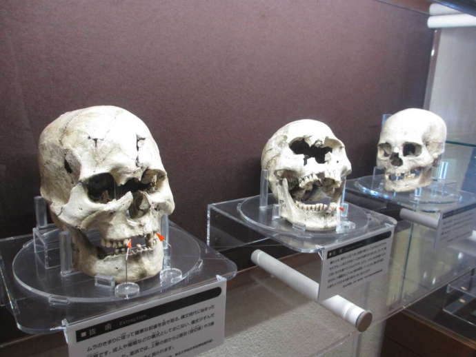 常設展で展示されている縄文人の頭蓋骨